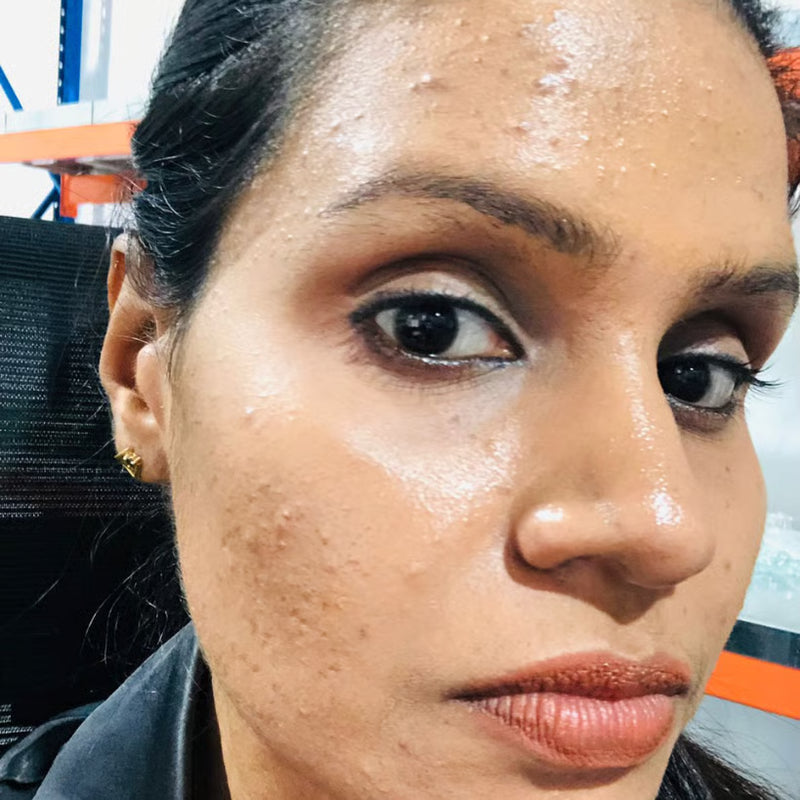 Before image of Frankincense Skin Regenerative Oil - Gold